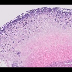 Meet your Posher, Chloe